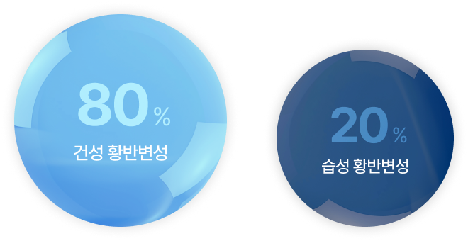 80% 건성 황반변성 20% 습성 황반변성